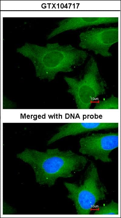 Polyclonal Rabbit anti-Human UBE2L3 / UBCH7 Antibody (aa92-154, IHC, WB)