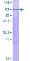 Human PNPLA2 / ATGL Protein (Recombinant GST)