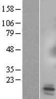 SPX Protein (Over-Expression Lysate Myc-DDK (Flag))