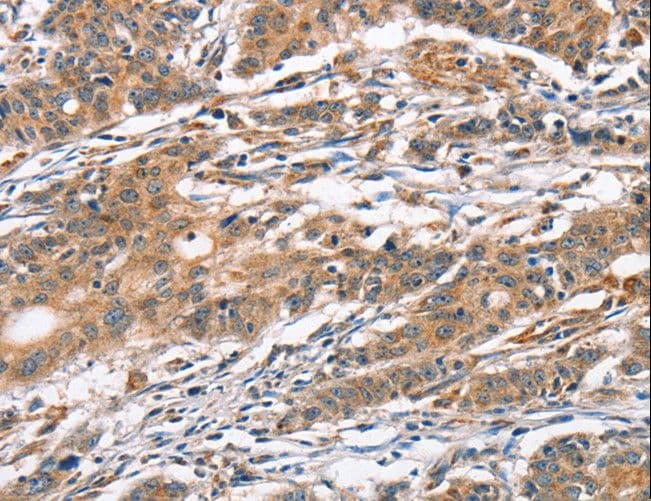 CAMK4 / CaMK IV Antibody