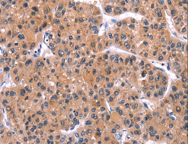 IRS1 Antibody