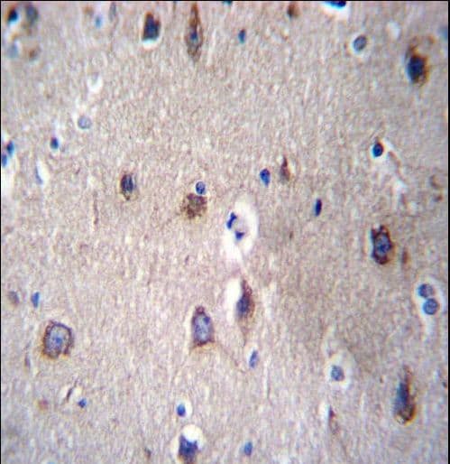 Polyclonal Rabbit anti-Human PCDHB14 Antibody (aa166-193, IHC, WB)