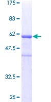 Human CENPH / CENP-H Protein (Recombinant GST)