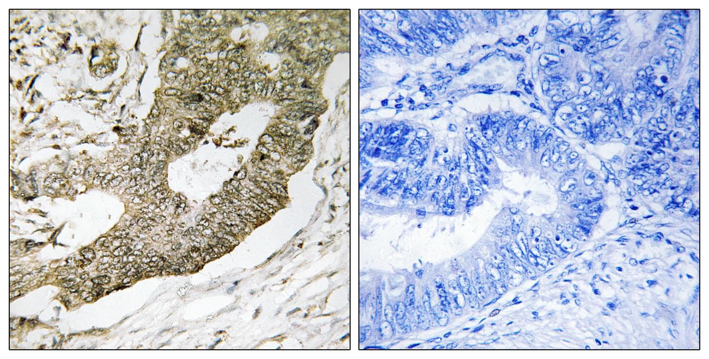 Polyclonal Rabbit anti-Human NUCKS1 Antibody (IHC)