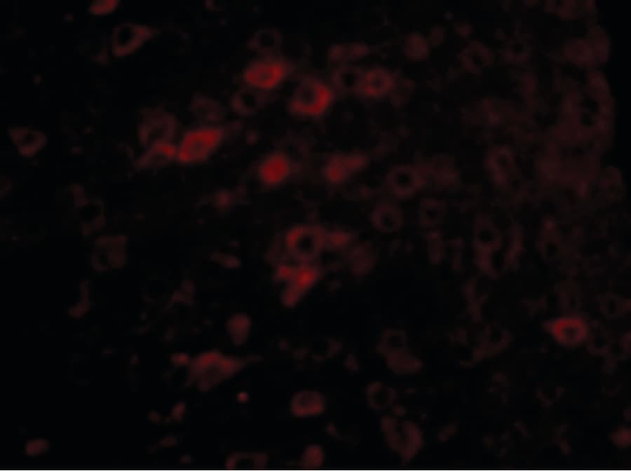IHC-plus™ Polyclonal Rabbit anti-Human CerS6 / LASS6 Antibody (IHC, IF, WB)