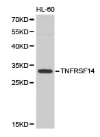 Polyclonal Rabbit anti-Human TNFRSF14 / CD270 / HVEM Antibody (IHC, WB)