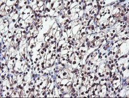 COPS5 / JAB1 Antibody (clone OTI2B12)