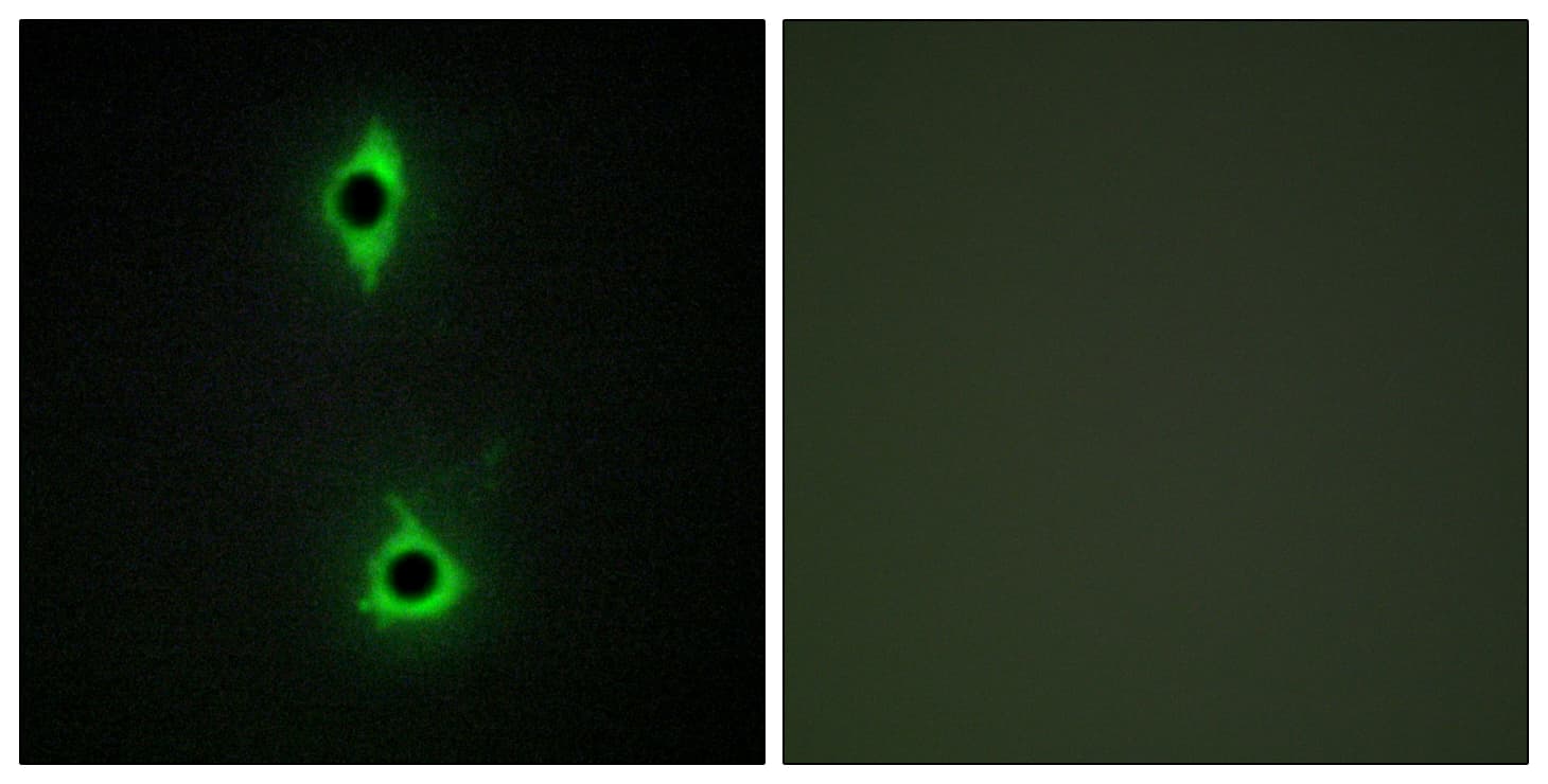 Polyclonal Rabbit anti-Human PIKFYVE / PIP5K Antibody (aa71-120, IF, WB)