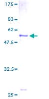 Human SLC25A20 / CACT Protein (Recombinant GST)
