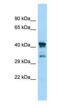 CHID1 Antibody (N-Terminus)
