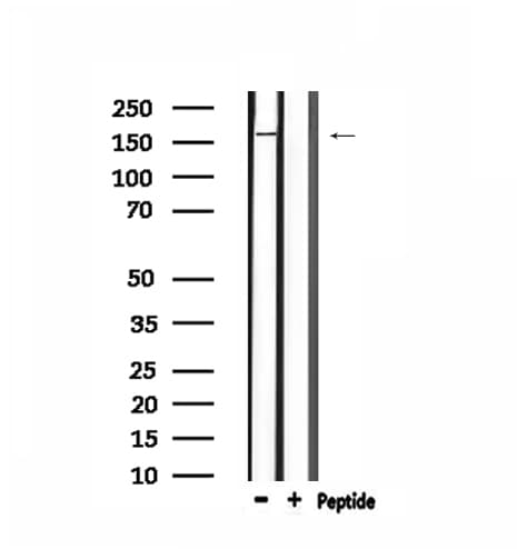 KPI-2 / LMTK2 Antibody
