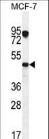 VEGFC Antibody (aa20-49)