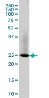 IHC-plus™ Monoclonal Mouse anti-Human RAB3B Antibody (clone 3F12, IHC, IF, WB)