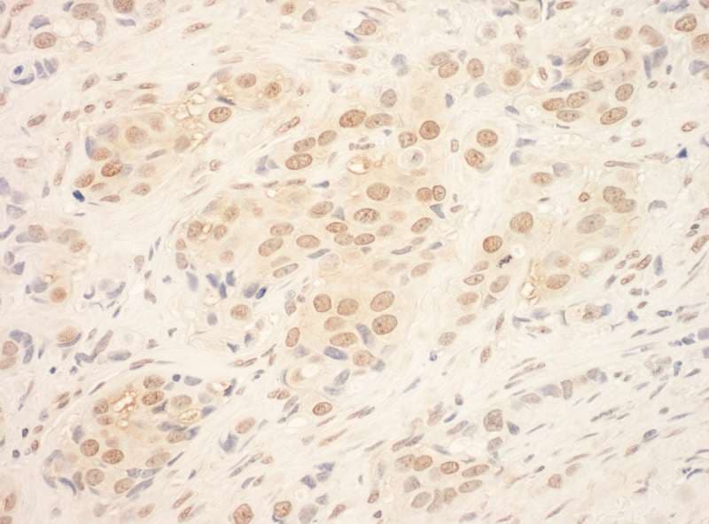 TDRD3 Antibody (aa601-651)