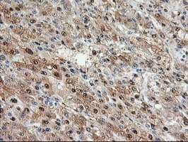 ACY1 / Aminoacylase 1 Antibody (clone OTI1B12)