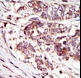 Polyclonal Rabbit anti-Human CAMK1G / CaMKI gamma Antibody (aa420-450, IHC, WB)