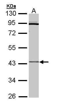 IHC-plus™ CRLF1 Antibody (aa130-415)