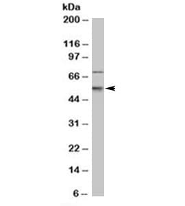 Monoclonal Mouse anti-Human CDKN1C / p57 Kip2 Antibody (clone 57P06, Azide-free,BSA-free, IHC, IF, WB)