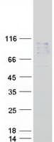 Human NAALAD2 Protein (Recombinant Myc-DDK (Flag))
