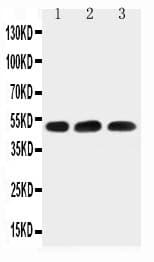 HYAL1 Antibody (aa32-47)