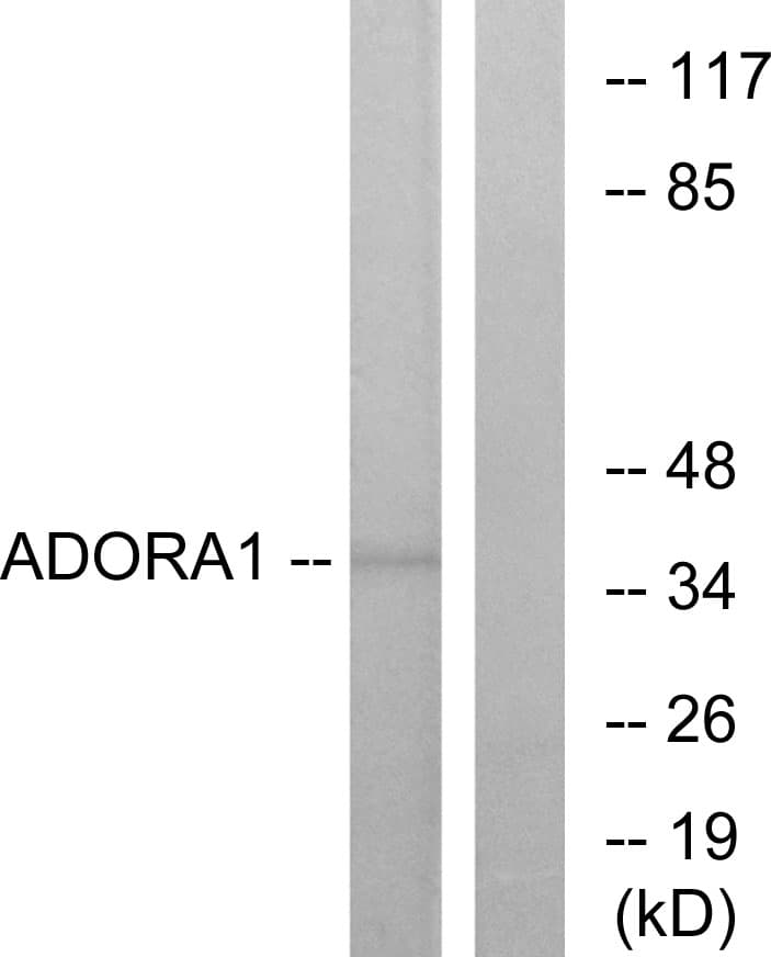 ADORA1 / Adenosine A1 Receptor Antibody (aa277-326)