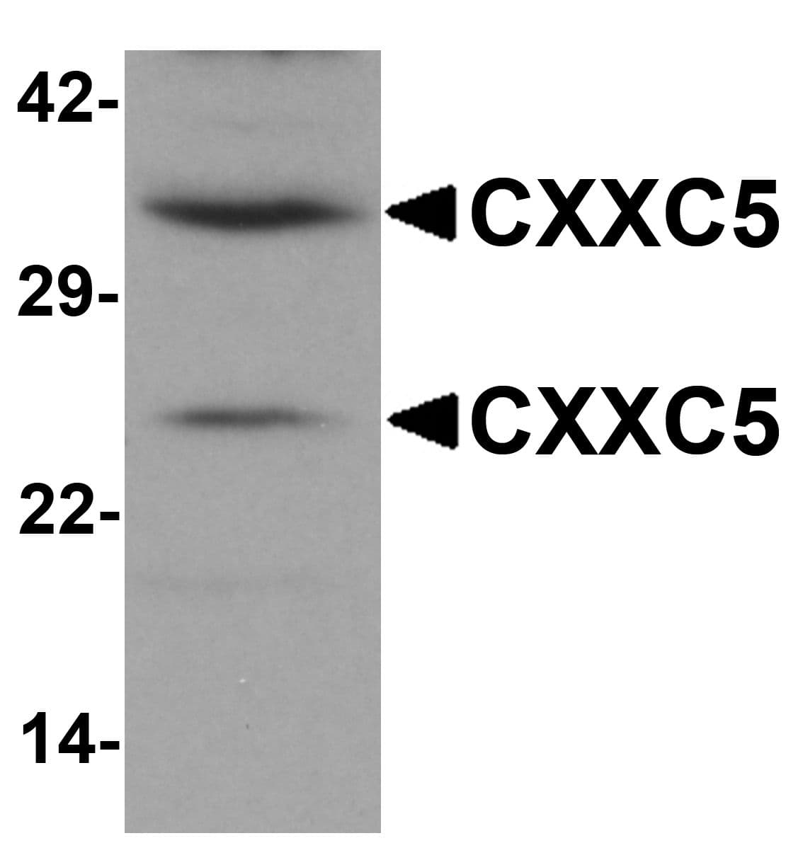 IHC-plus™ Polyclonal Rabbit anti-Human CXXC5 Antibody (IHC, IF, WB)