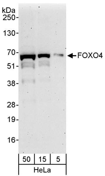 FOXO4 / AFX1 Antibody (aa455-505)