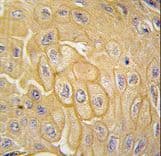 NEP / DDR1 Antibody