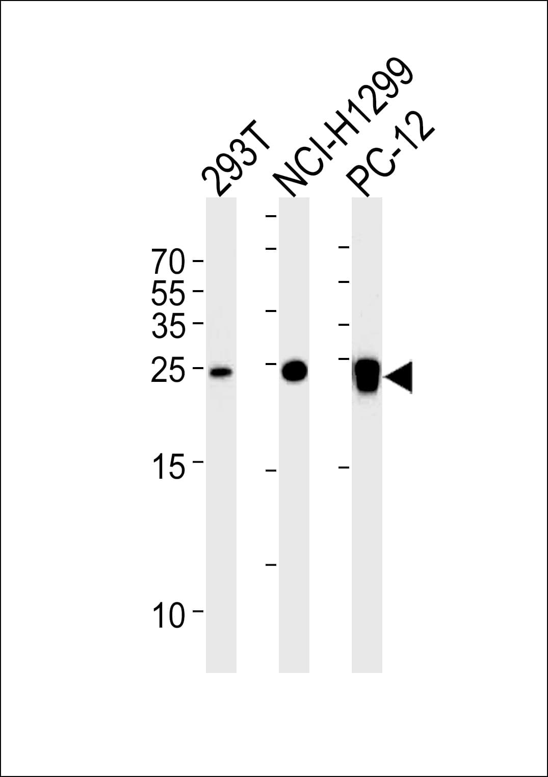 Monoclonal Mouse anti-Human UCHL1 / PGP9.5 Antibody (clone 696CT2.1.4, WB)