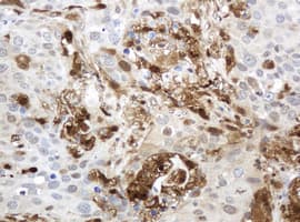 TP / Thymidine Phosphorylase Antibody (aa311-482, clone OTI1E7, Carrier-free)