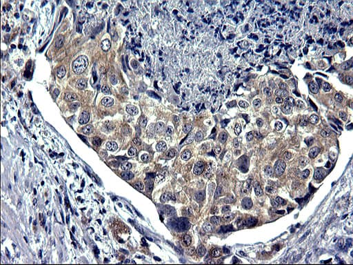 TXNDC5 / ERP46 Antibody (clone OTI1C3)