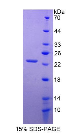 Human ARNT / HIF-1-Beta Protein (Recombinant His-S)