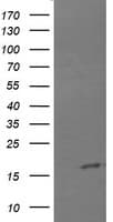 CTAG1B / NY-ESO-1 Antibody (clone OTI2B4)