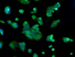 IHC-plus™ Heat Shock Protein 70 / HSPA1A Antibody (clone 5F3)