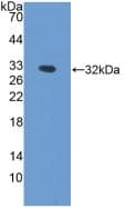 HPX / Hemopexin Antibody (aa31-242)