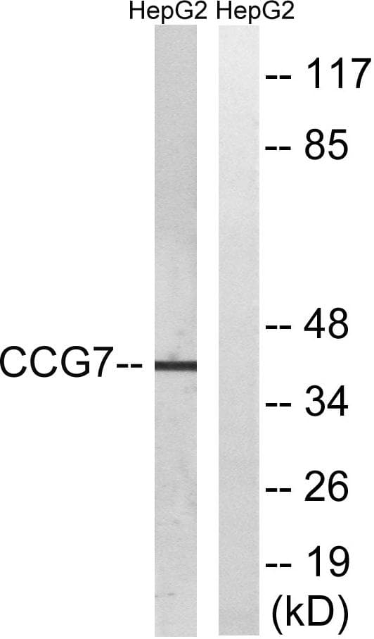 Polyclonal Rabbit anti-Human CACNG7 Antibody (WB)