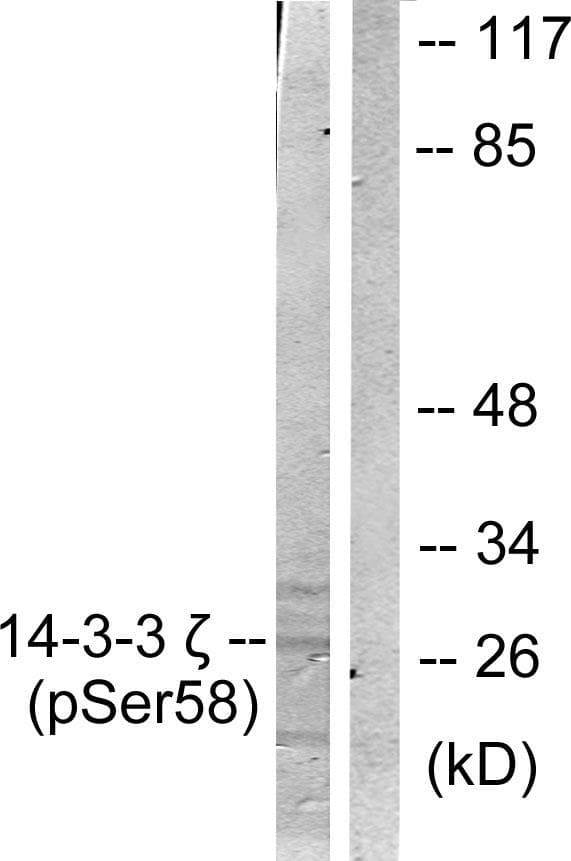 Polyclonal Rabbit anti-Human YWHAZ / 14-3-3 Zeta Antibody (phospho-Ser58, IHC, IF, WB)