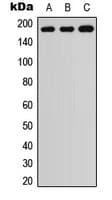 ADAMTS7 Antibody (aa197-236)