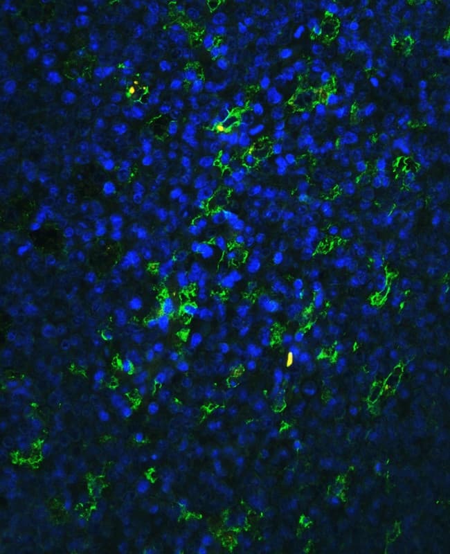 Polyclonal Rabbit anti-Human ITGB2 / CD18 Antibody (aa404-769, IHC, WB)