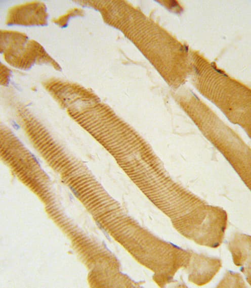 Polyclonal Rabbit anti-Human ITPKC Antibody (aa89-117, IHC, WB)