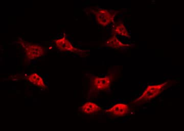 Polyclonal Rabbit anti-Human PARK7 / DJ-1 Antibody (IF, WB)
