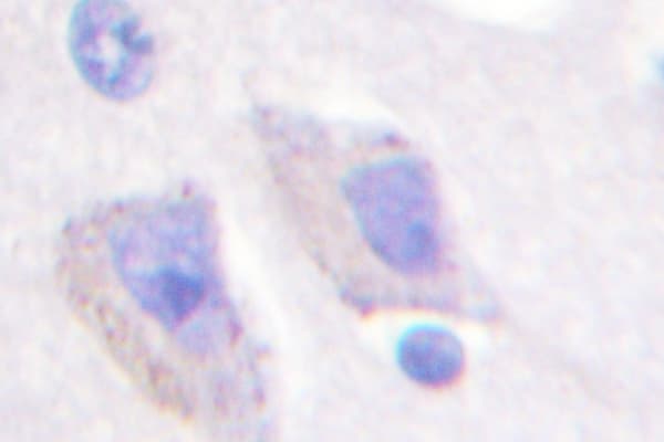 PRKAB1 / AMPK Beta 1 Antibody (Val175)