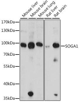SOGA1 Antibody