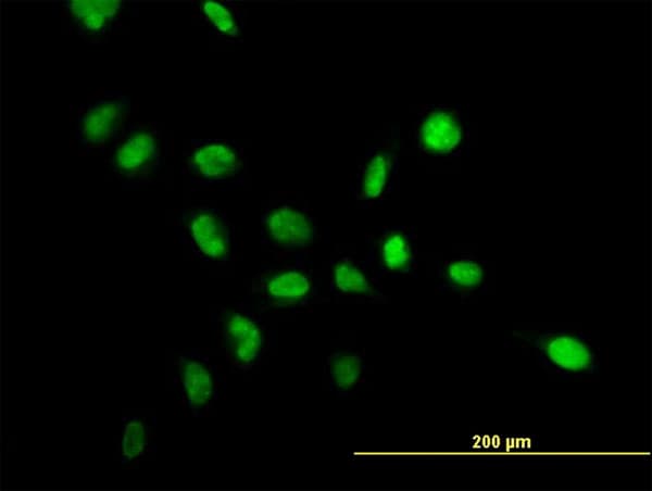Monoclonal Mouse anti-Human NPM1 / NPM / Nucleophosmin Antibody (clone 3B2, IF, WB)