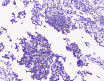 Polyclonal Rabbit anti-Human PRKCG / PKC-Gamma Antibody (IHC, WB)