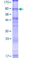 Human SVOP Protein (Recombinant GST)