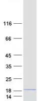 Human SMCO4 Protein (Recombinant Myc-DDK (Flag))