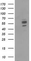 CNDP1 Antibody (clone OTI1A5)