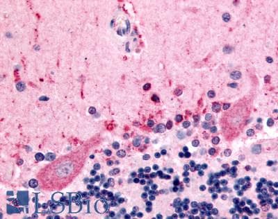 IHC-plus™ CELSR3 Antibody (N-Terminus)