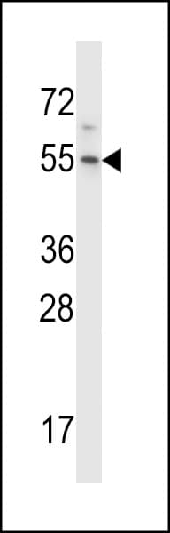 HM13 / IMP-1 / SPP Antibody (aa325-354)